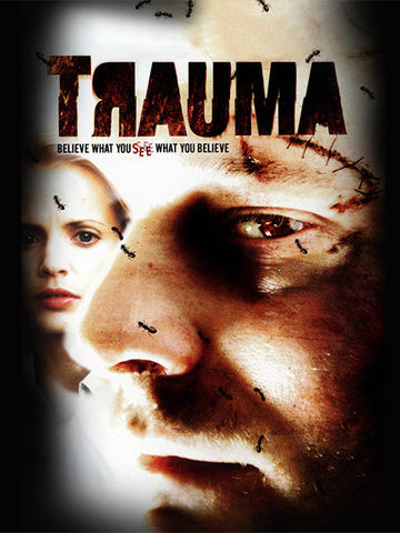 Trauma