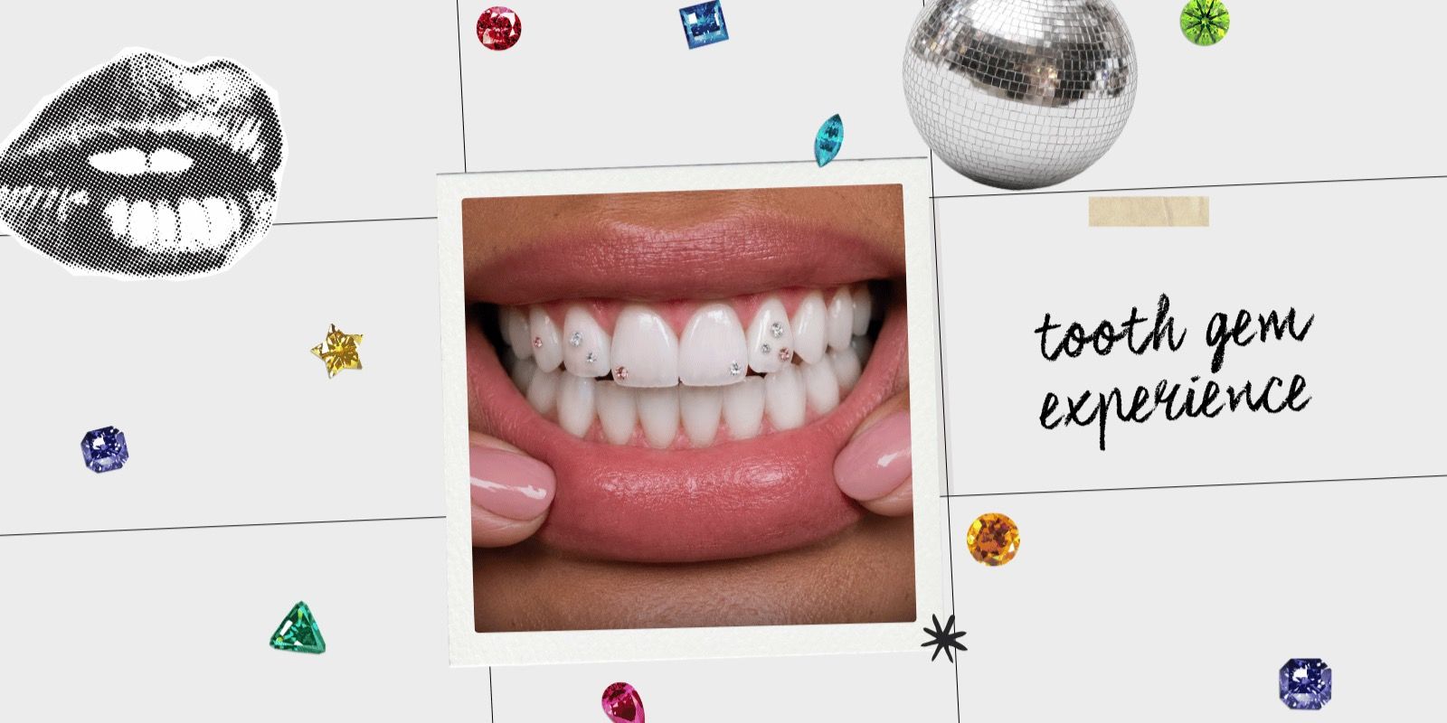 Tooth Gem experience